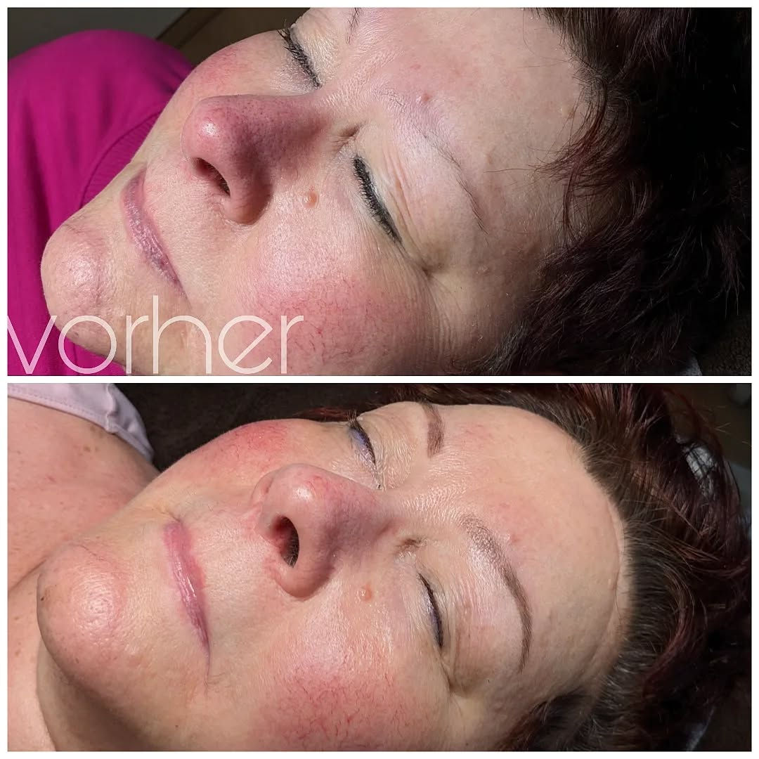 Vorher-Nachher: Lippenpigmentierung und Augenbrauen bei einer Kundin